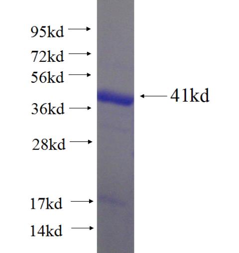 Recombinant human PDXK SDS-PAGE