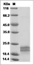 Rat IL17F / IL-17F Protein (His Tag) SDS-PAGE
