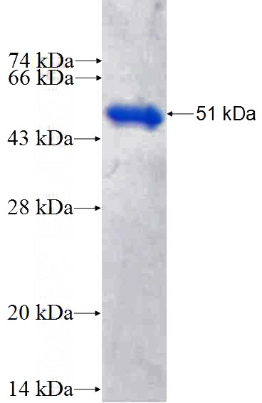 Recombinant Human C17orf80 SDS-PAGE