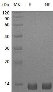 Human PF4/CXCL4/SCYB4 (His tag) recombinant protein