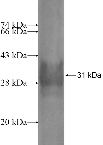 Recombinant Human PI15 SDS-PAGE