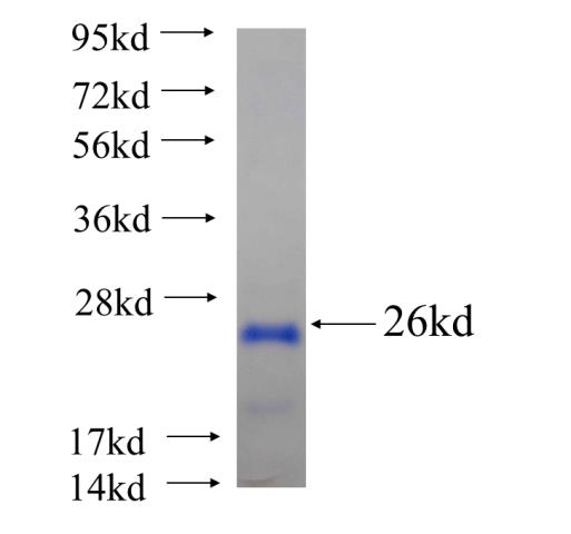 Recombinant human UBL4B(Full length) SDS-PAGE