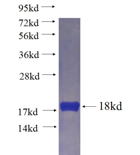 Recombinant human KRIT1 SDS-PAGE