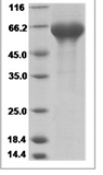 Human LRRTM2 Protein 14113