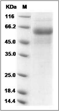 Rat DDR2 Kinase / CD167b Protein (His Tag) SDS-PAGE