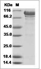 Human N-Cadherin / CD325 / CDH2 Protein (His Tag)