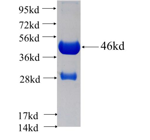 Recombinant human TNFAIP8L2 SDS-PAGE