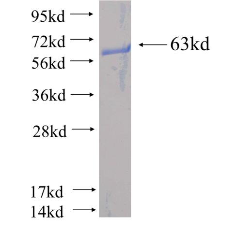 Recombinant human UBLCP1(Full length) SDS-PAGE