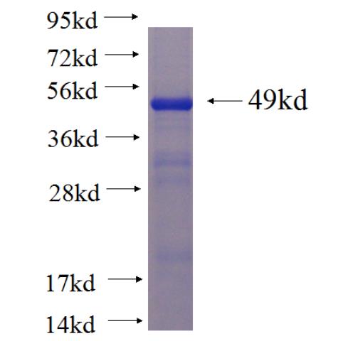 Recombinant Arabidopsis thaliana DJ1D SDS-PAGE
