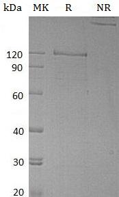 Human NRCAM/KIAA0343 (Fc tag) recombinant protein