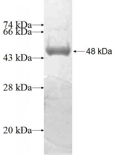 Recombinant Human PPP3CC SDS-PAGE
