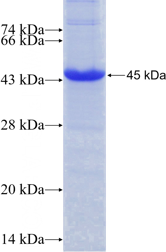Recombinant Human PLA2R1 SDS-PAGE