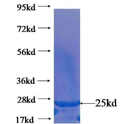 Recombinant human LPPR4 SDS-PAGE