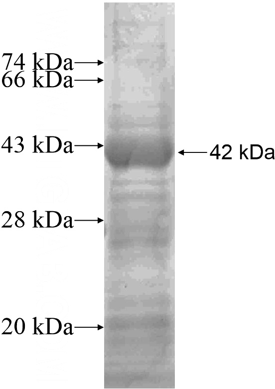 Recombinant Human PDE11A SDS-PAGE