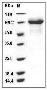 Human IL12RB1 / IL12RB / CD212 Protein (His Tag) SDS-PAGE