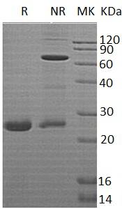 Human BNIP3/NIP3 (His tag) recombinant protein