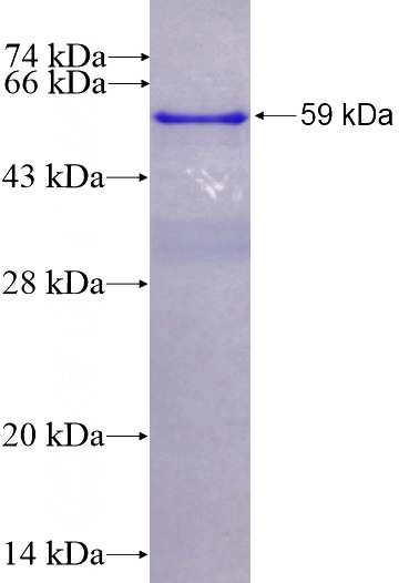 Recombinant Human SMAD4 SDS-PAGE