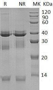 Mouse Ctsl/Ctsl1 (His tag) recombinant protein