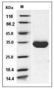 Human EPO Receptor / EPOR Protein (His Tag) SDS-PAGE