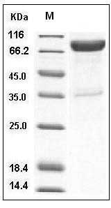 Human IL10Rb Protein (His & Fc Tag) SDS-PAGE