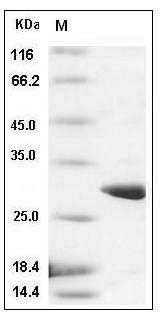 Schistosoma japonicumGlutathione S-transferase / GST Protein SDS-PAGE