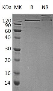 Human IL1RAP/C3orf13/IL1R3 (Fc & His tag) recombinant protein