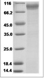 Human B7H7 / HHLA2 Protein (ECD, Fc Tag)