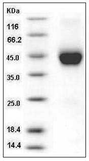 Human Cystatin 7 / CST7 Protein (His Tag) SDS-PAGE