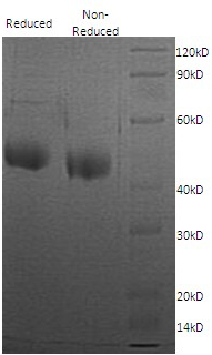 Human ST8SIA1/SIAT8/SIAT8A (His tag) recombinant protein
