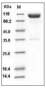 Mouse Axl Kinase Protein (His & Fc Tag) SDS-PAGE