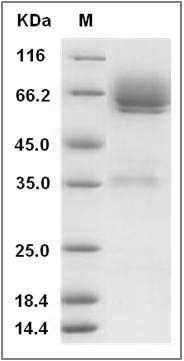 Mouse LYVE1 / LYVE-1 Protein (Fc Tag) SDS-PAGE