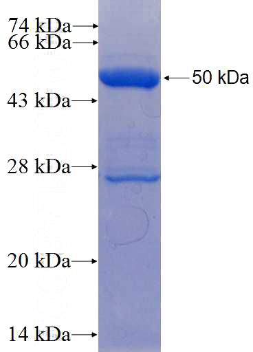Recombinant Human MAD2L2 SDS-PAGE