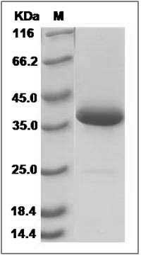 Human SCGB3A1 / HIN-1 Protein (Fc Tag) SDS-PAGE
