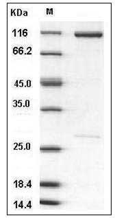 Human beta-Catenin / CTNNB1 Protein (His & GST Tag) SDS-PAGE