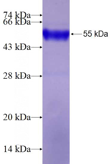Recombinant Human C1orf35 SDS-PAGE