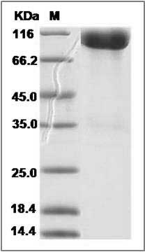 Rat ALCAM / CD166 Protein (Fc Tag) SDS-PAGE