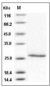 Human CD4 / LEU3 Protein (aa 1-208, His Tag) SDS-PAGE