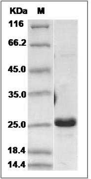 Human Interferon alpha-B / IFNA8 Protein SDS-PAGE