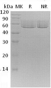 Mouse Cx3cl1/Cx3c/Fkn/Scyd1 (His tag) recombinant protein