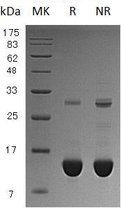 Human S100P/S100E (His tag) recombinant protein