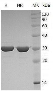 Human FGF8/AIGF (His tag) recombinant protein