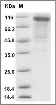 Mouse Cadherin-6 / CDH6 Protein (His Tag) SDS-PAGE