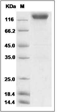 Rat VEGFR2 / Flk-1 / CD309 / KDR Protein (Fc Tag) SDS-PAGE
