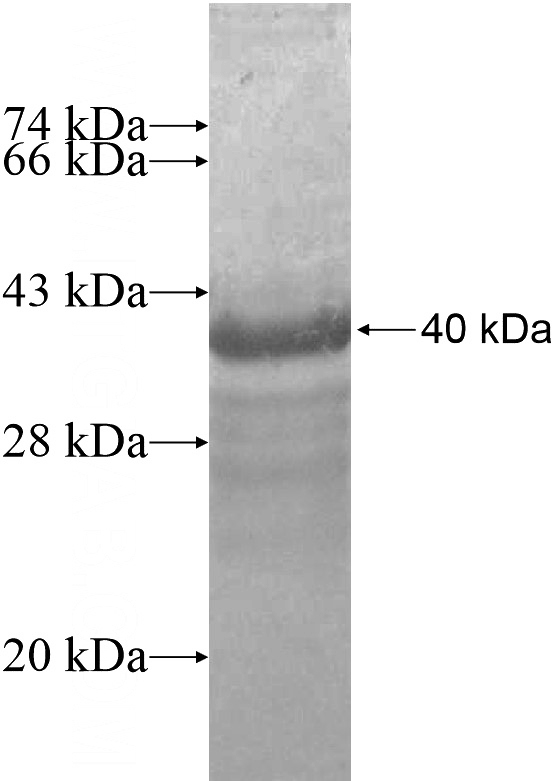 Recombinant Human ER81 SDS-PAGE