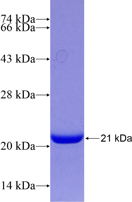 Recombinant Human C3orf14 SDS-PAGE