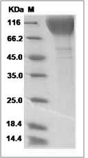 HIV-1 gp120 Protein (group P, strain RBF168) (His Tag) SDS-PAGE