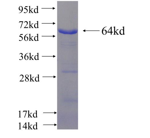 Recombinant human PKM SDS-PAGE