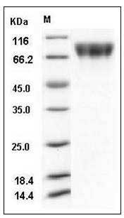 Human c-KIT / CD117 Protein (His Tag) SDS-PAGE