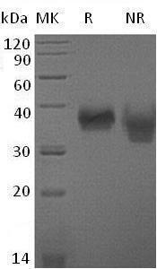 Mouse Cd84/Slamf5 (His tag) recombinant protein