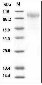 Human RSV (A, rsb1734) glycoprotein G / RSV-G Protein (95% Homology) (His Tag) SDS-PAGE